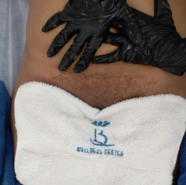 Bikini waxing