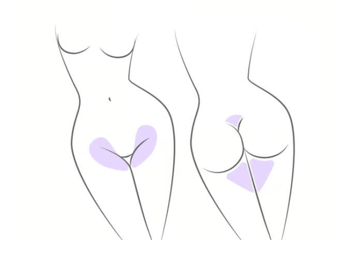 Brazilian waxing 